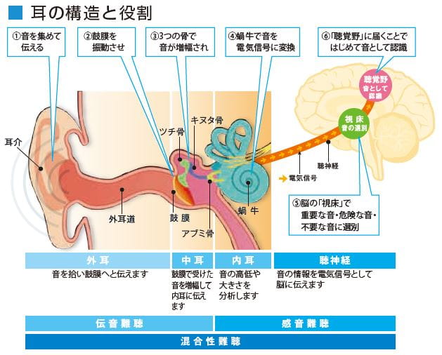 大半が治療可能 難聴の種類 その二 伝音性難聴 シグニア補聴器 Signia